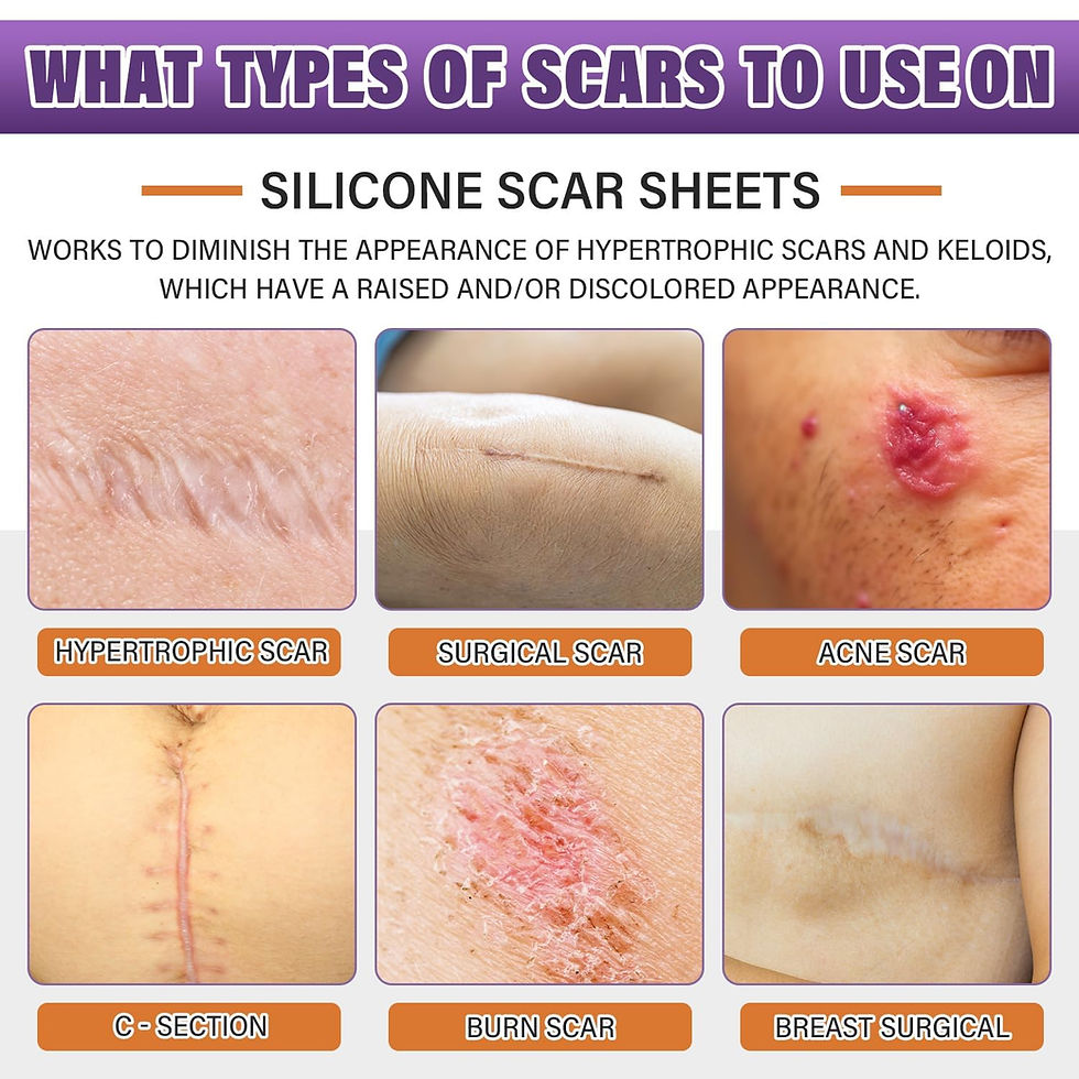 Thumbnail: Silicone Scar Sheet