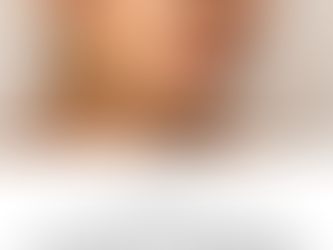 SculpLase: The VBoutique No-Downtime Lift for a Snatched, Natural Jawline