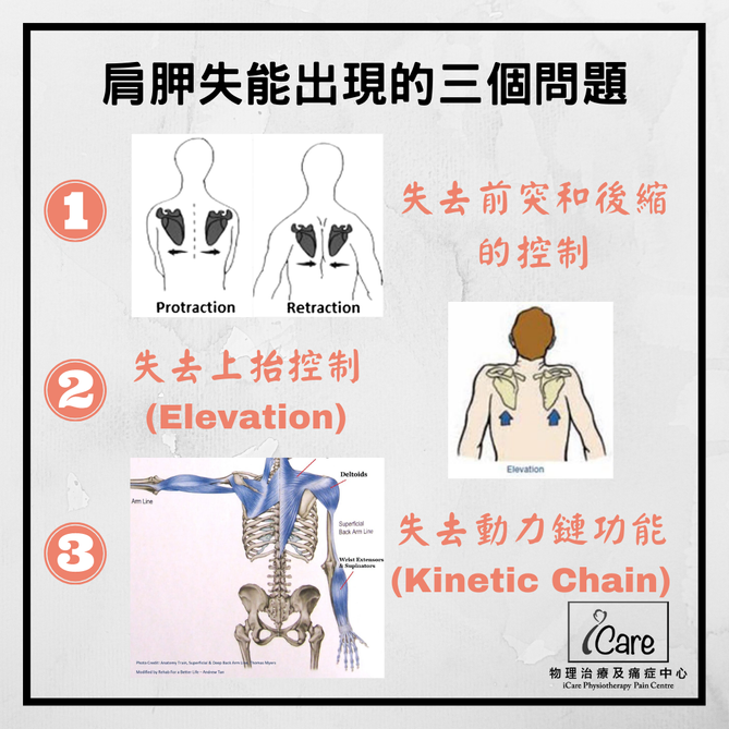 金門美兆診所 ＷＨＯ ＮＧＯ 前鋸肌失能