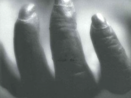 The timely death of Peter Straub