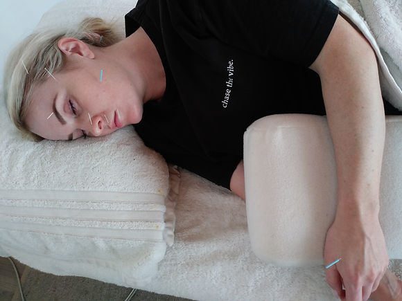 Acupuncture for facial paralysis