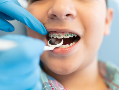 orthodontic services