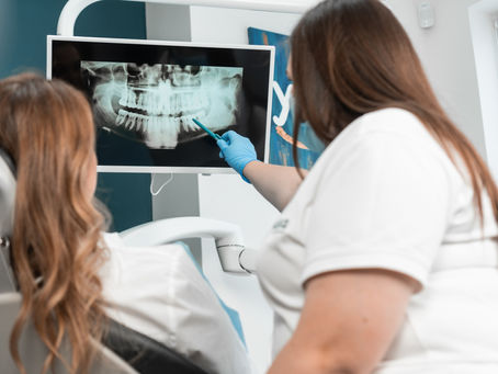 Dental implants