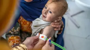 UNICEF: Afghanistan on Brink of Peak Child Malnutrition Crisis