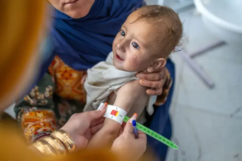Image: UNICEF/UN0877098/Khayyam
Afghanistan on Brink of Peak Child Malnutrition Crisis