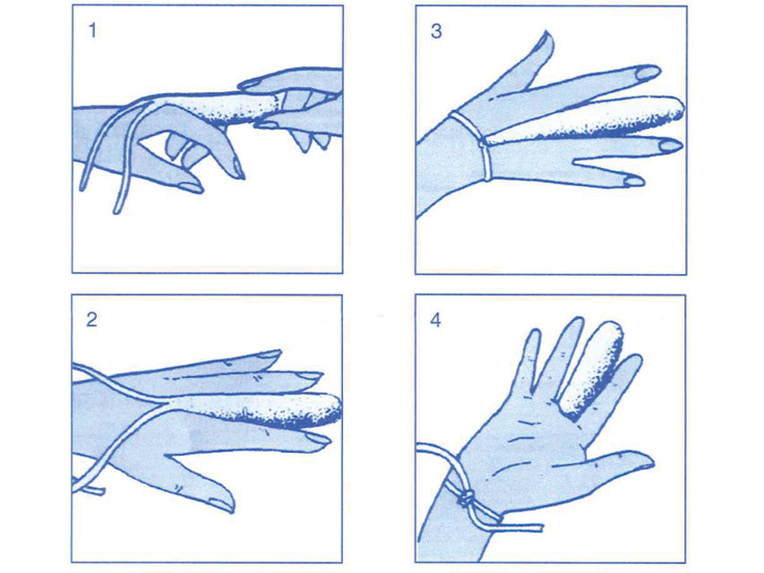 Thumbnail: SINGLEFIX FINGER DRESSING - medium
