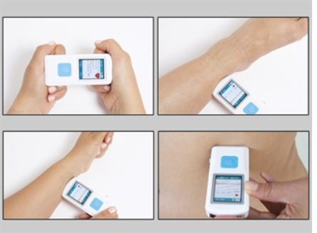 Thumbnail: PM10 PALM ECG