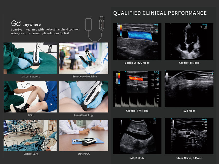Thumbnail: SONOEYE P6 DIGITAL COLOUR DOPPLER - Micro-Convex Probe