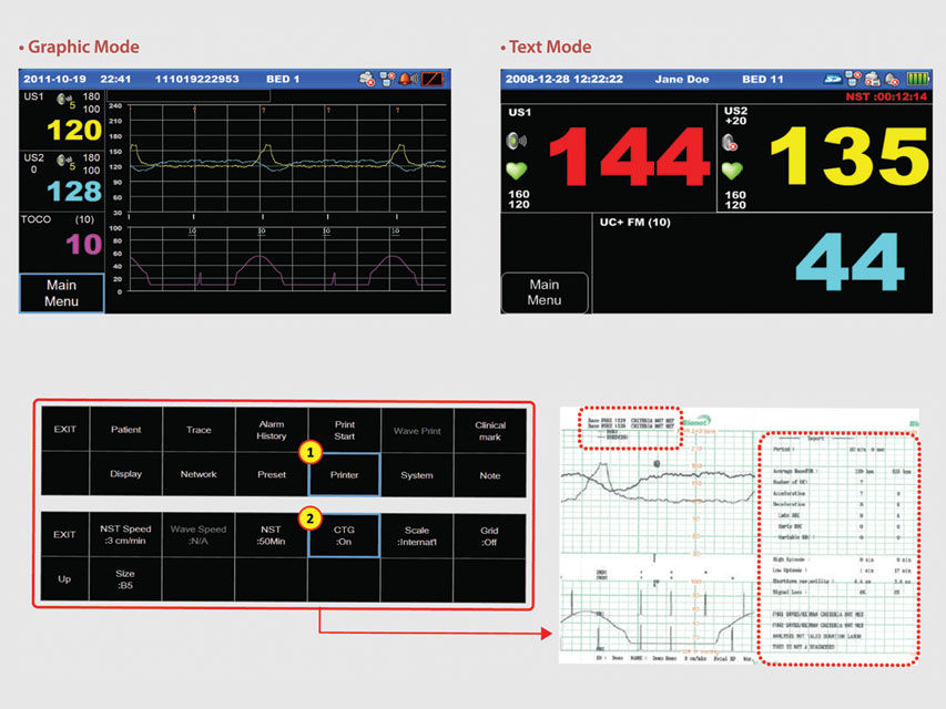 Thumbnail: GIMA FC1400 SINGLE FOETAL MONITOR