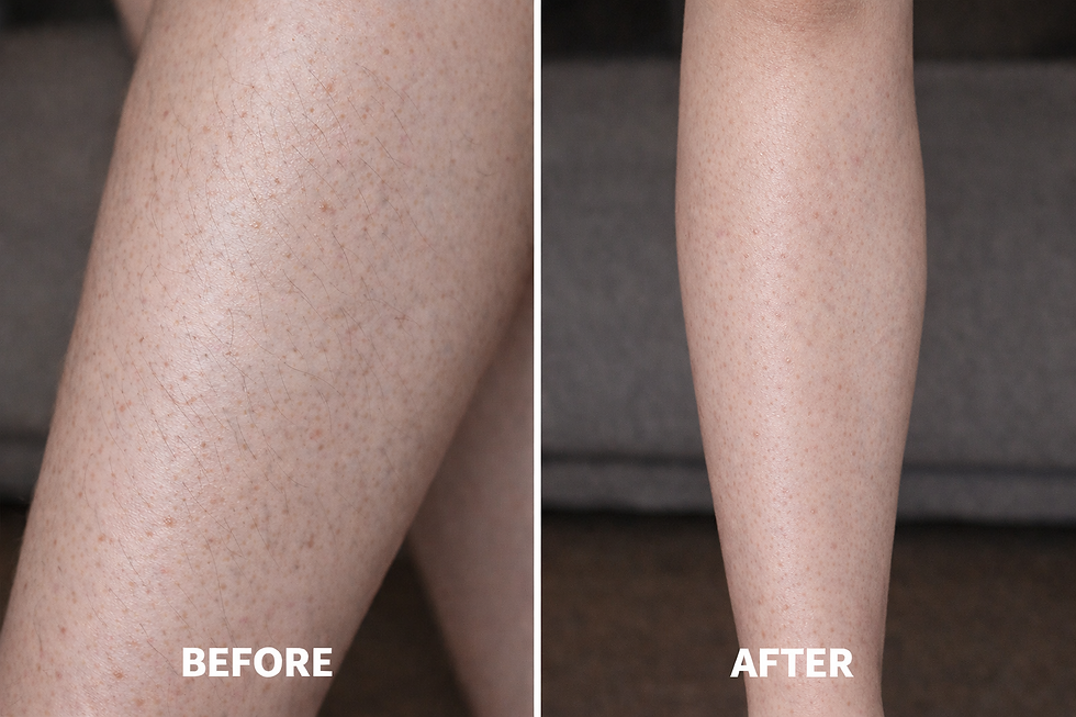 Before and after leg hair for LP (Berry Smooth).png