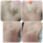 Gentle underarm waxing for smooth, clean skin and longer-lasting results.