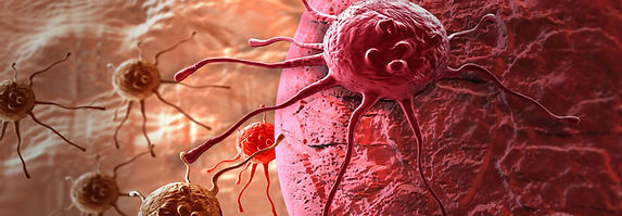 20-วิธี-หลีกหนีจากโรคมะเร็งในชีวิตประจำว