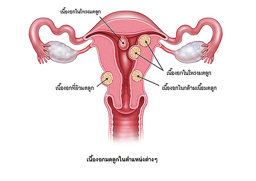 ภาพหน้าจอ 2562-08-17 เวลา 18.03.06.png
