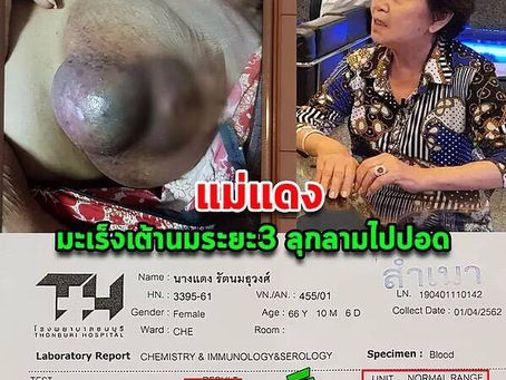 มะเร็งเต้านมระยะที่3 ลุกลามไปปอด