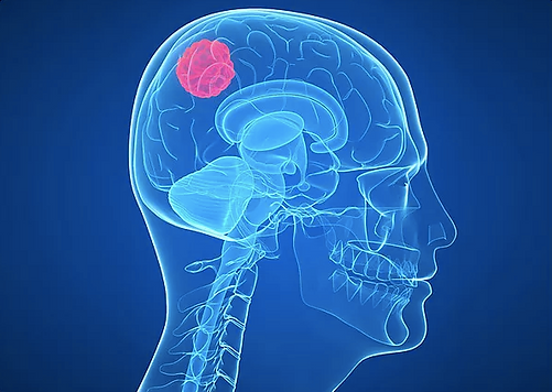 ภาพหน้าจอ 2562-08-17 เวลา 18.02.42.png