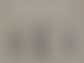 QUAL É O MELHOR TIPO DE IMPLANTE DENTÁRIO? DESCUBRA A OPÇÃO IDEAL PARA VOCÊ