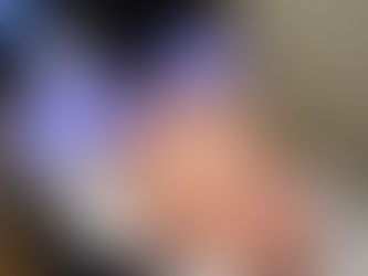 scalp micropigmentation hair loss treatment