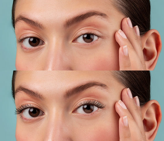 The Ultimate Guide to Latisse: How to Grow Longer, Fuller Lashes by Summer