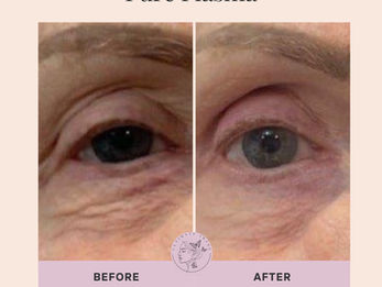 Tighten, lift, and restore your skin’s natural glow.