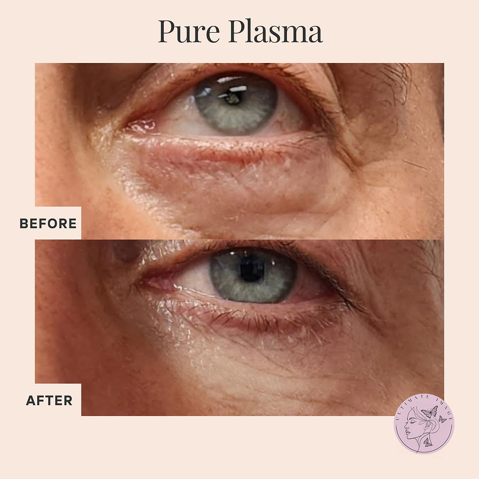 Non-surgical skin rejuvenation for a fresh, youthful look.