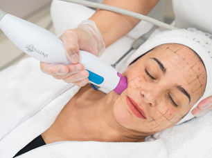 What Makes Thermage One of the Best Summer Skin Tightening Treatments?