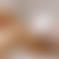 Laser Hair Removal FAQs: What Florida Patients Need to Know