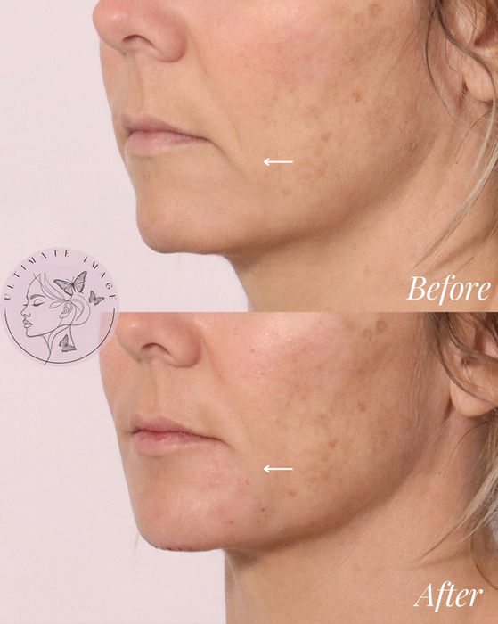 Enhance definition and create a natural, balanced result