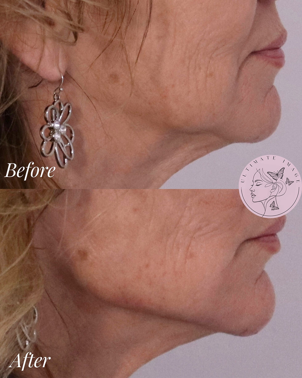 Enhance and balance the shape of the jaw