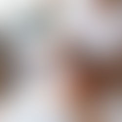 How IPL Can Reverse Sun Damage Before Summer