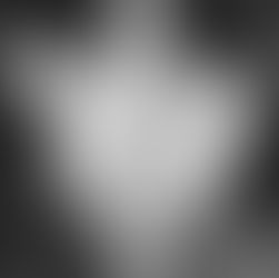 Mexico Surrogacy: Marilyn Monroe Childless Truth & Endometriosis POWER IVF