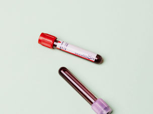 成功第一步:墨西哥试管前准父母的全面检查清单