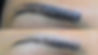 Eyebrow-tattoo-removal-with-remover.jpg