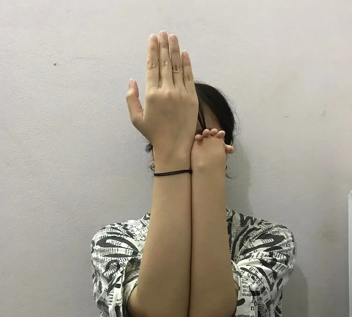 Below Elbow Upper Limb Amputee