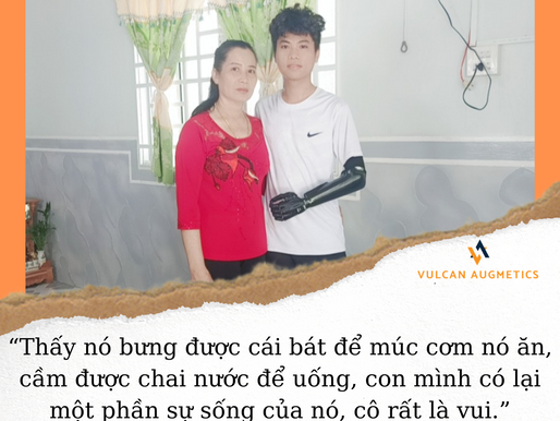 #CÁNH TAY GIA ĐÌNH 1: "Từ lúc gắn tay giả, Thuận đi ra đường lúc nào cũng thích mang"
