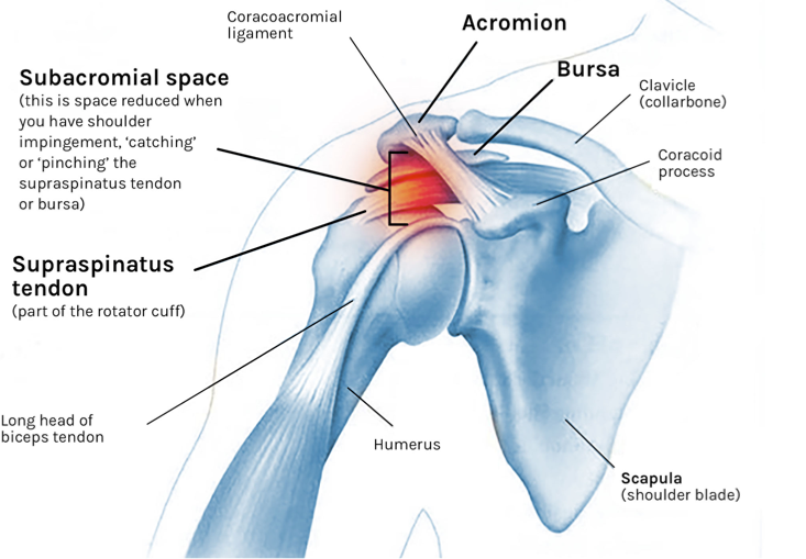 Shoulder Impingement Causes & How to Fix It LaptrinhX / News