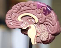 Concussions 2_edited_edited.png