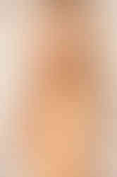 TopPlasticSurgeonsMexico | Breast Implants surgery in Mexico - Patient's review. Breast Augmentation Experience in Mexico.