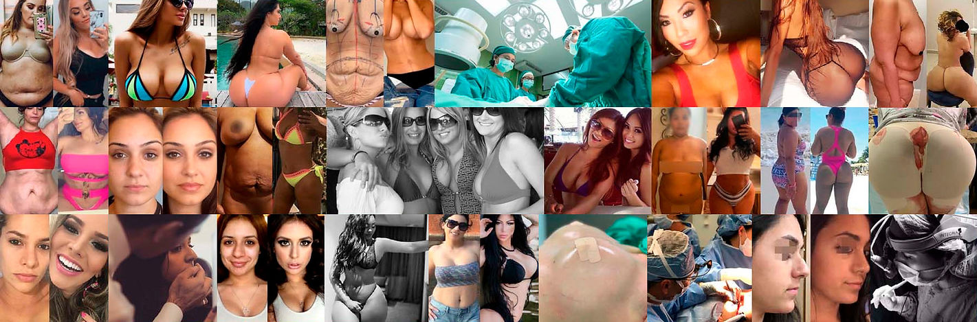 Plastic Surgery in Mexico - TopPlasticSurgeonsMexico.jpg