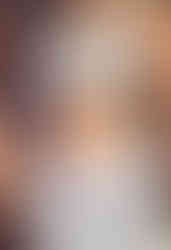 After my plus size Tummy Tuck | TopPlasticSurgeonsMexico