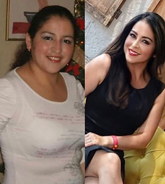 All Inclusive Plastic Surgery Mexico
