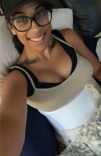 After my plus size Tummy Tuck | TopPlasticSurgeonsMexico