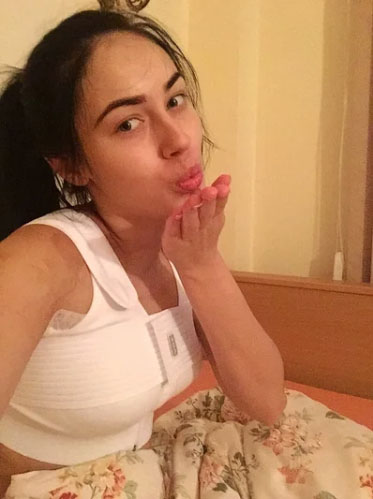 TopPlasticSurgeonsMexico | Breast Augmentation surgery in Mexico - Breast implants Patient's review. Breast augmentation Experience in Mexico. Breast Augmentation journey in Mexico with TopPlasticSurgeonsMexico