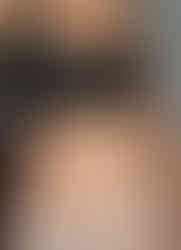 After my plus size Tummy Tuck | TopPlasticSurgeonsMexico