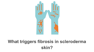 fibrosis.png