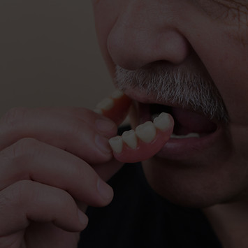 An old gray-haired man puts on his denture. The man holds the denture. Implant. Orthodonti