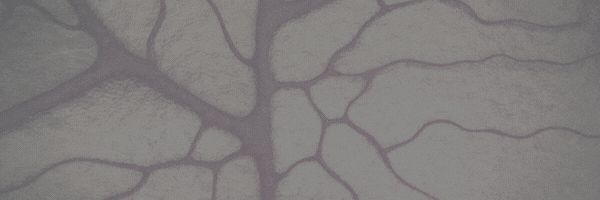 Dr Gustavo Melo de Andrade Lima Neurolog