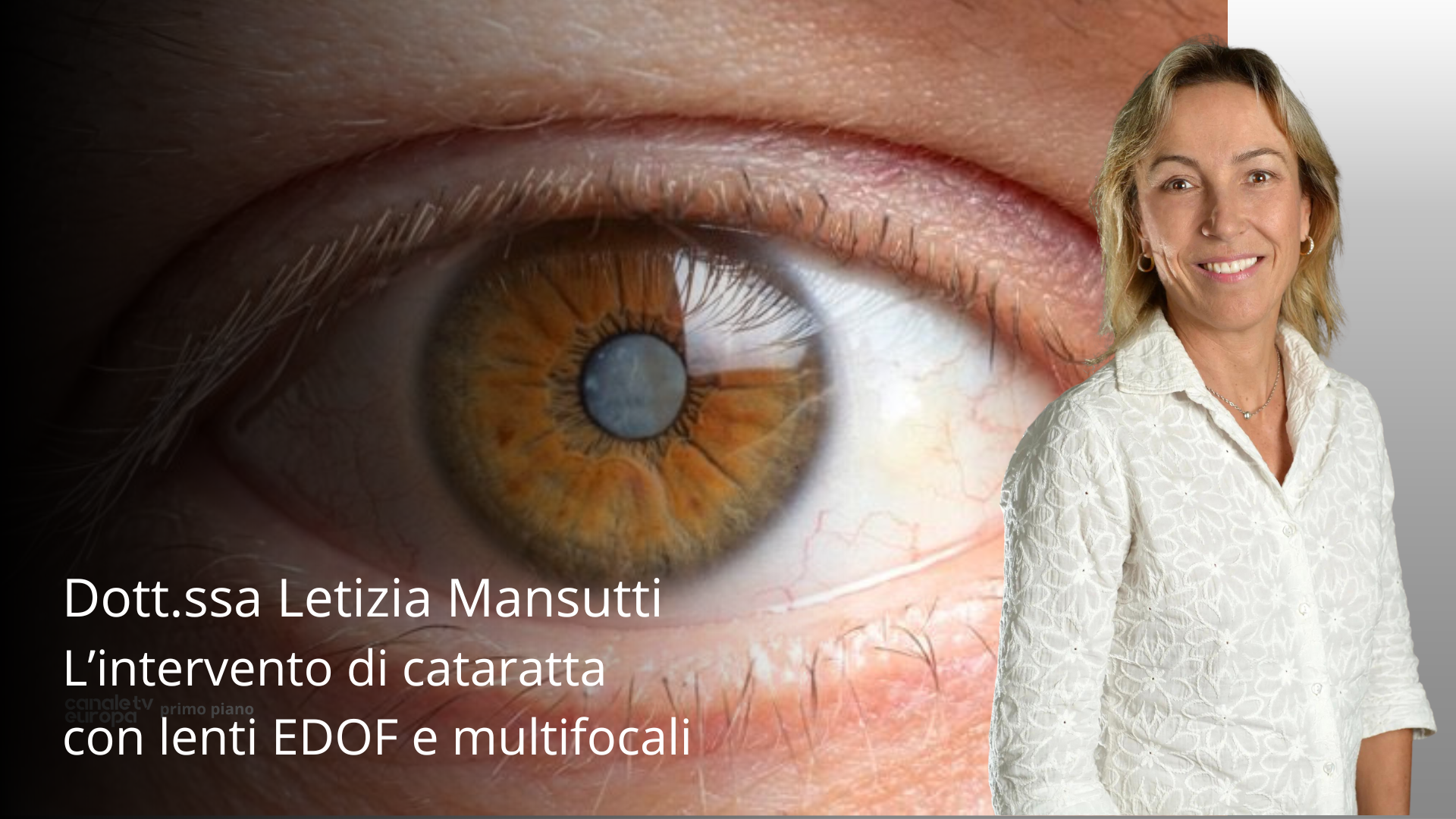 Dr Letizia Mansutti: L’intervento di cataratta con lenti EDOF e multifocali