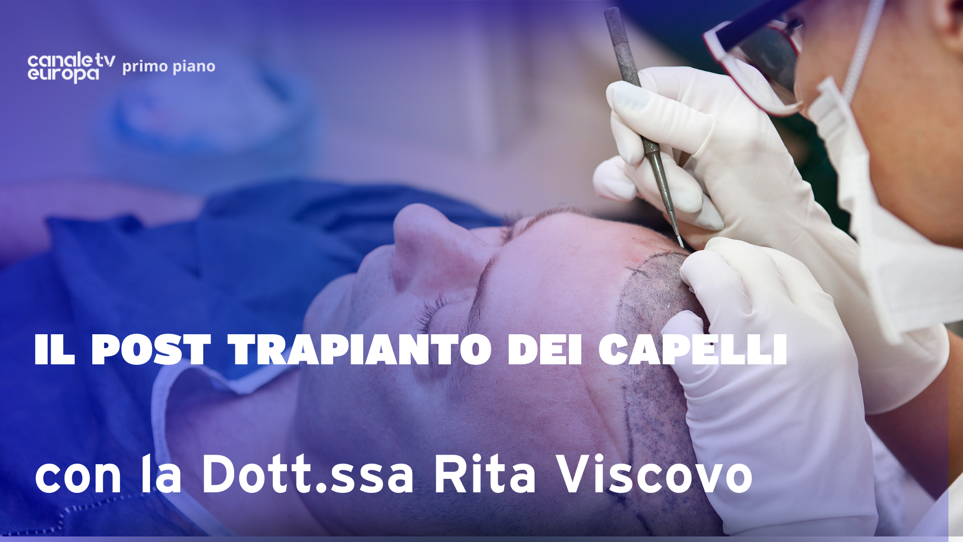 Il post trapianto de capelli