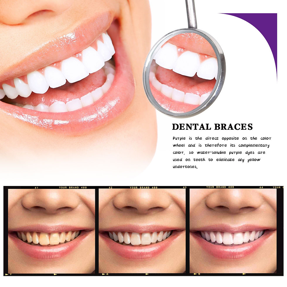 Miniatura: Creme dental clareador V34 30ml, removedor intensivo de manchas para dentes amar