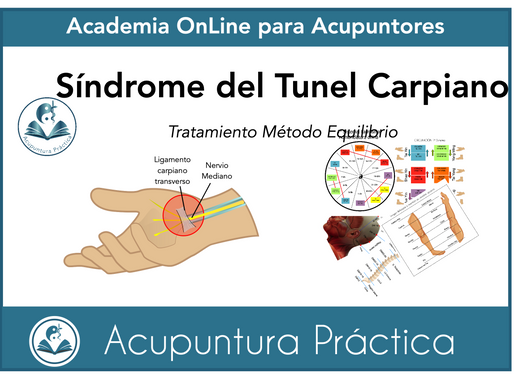 Síndrome del Túnel Carpiano